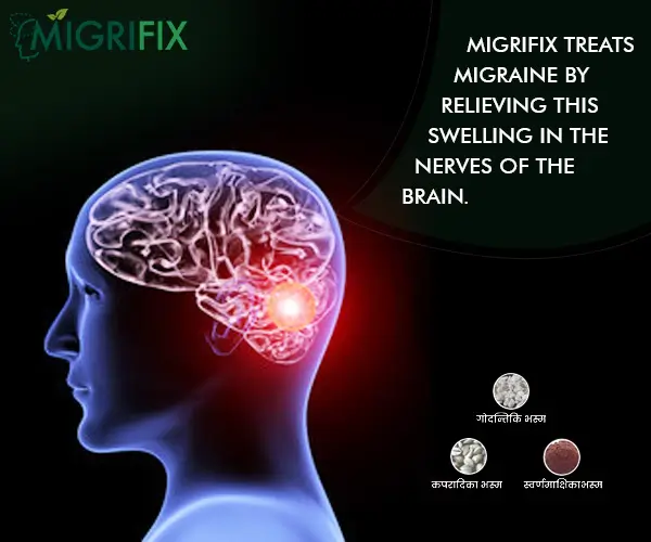 Migrfix Treats